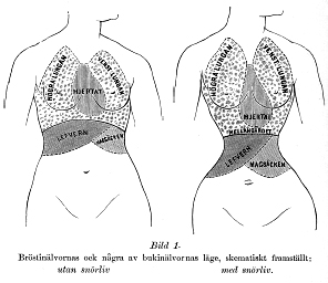 Illustration som visar hur inälverna i buken pressas samman av snörliv.